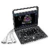 Ultraschallgerät SonoScape E2, tragbar, Farb-Doppler-Ultraschallsystem, 1 Stück